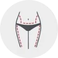 Lipoescultura