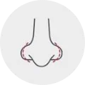 Rinoplastia